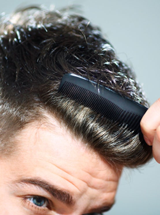 La caída del cabello en el hombre